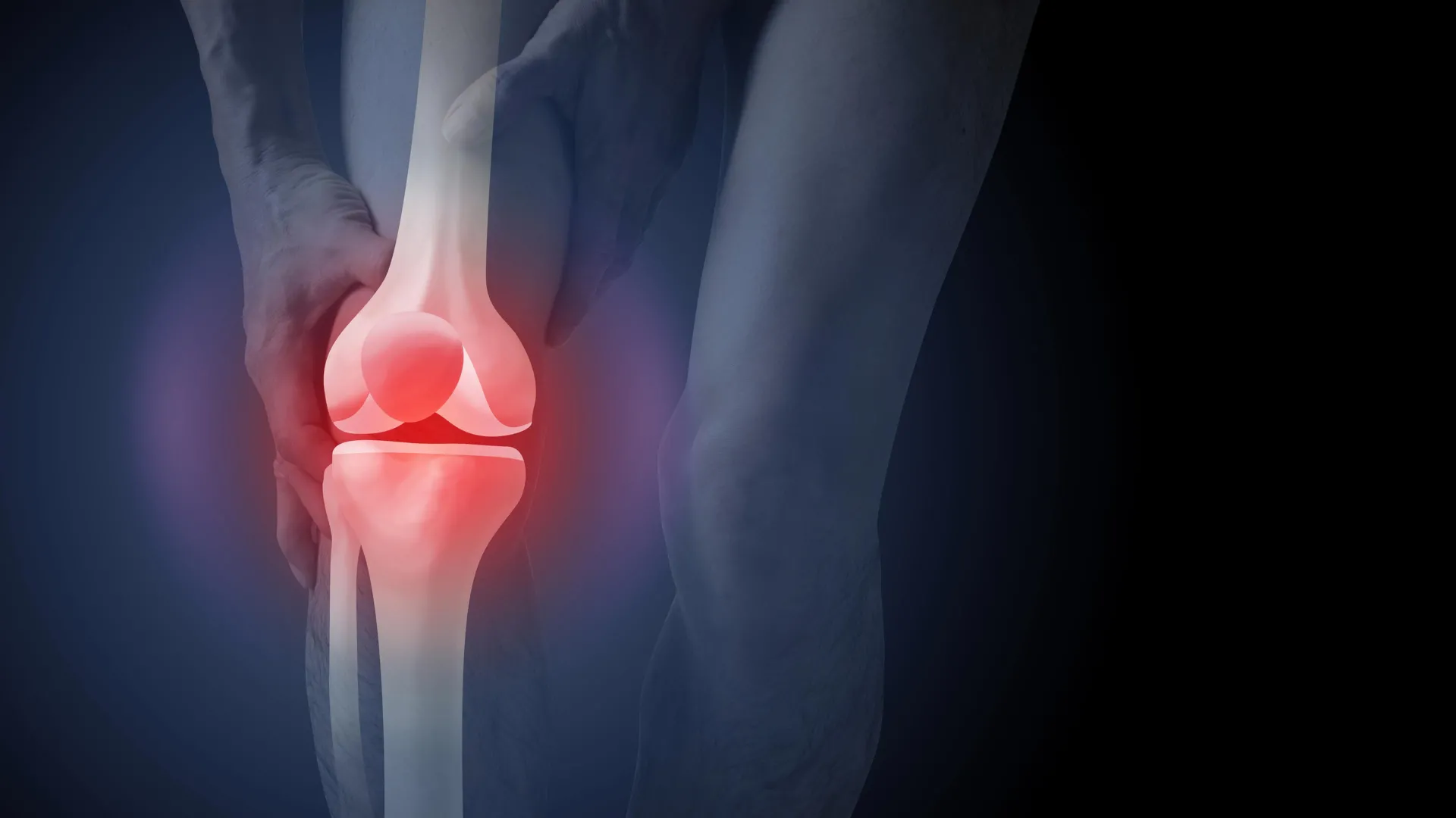 How X-Rays Drive Knee Arthritis Patients to Surgery
